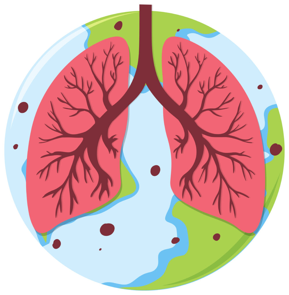 Lung Cancer