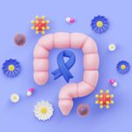 Colon Cancer